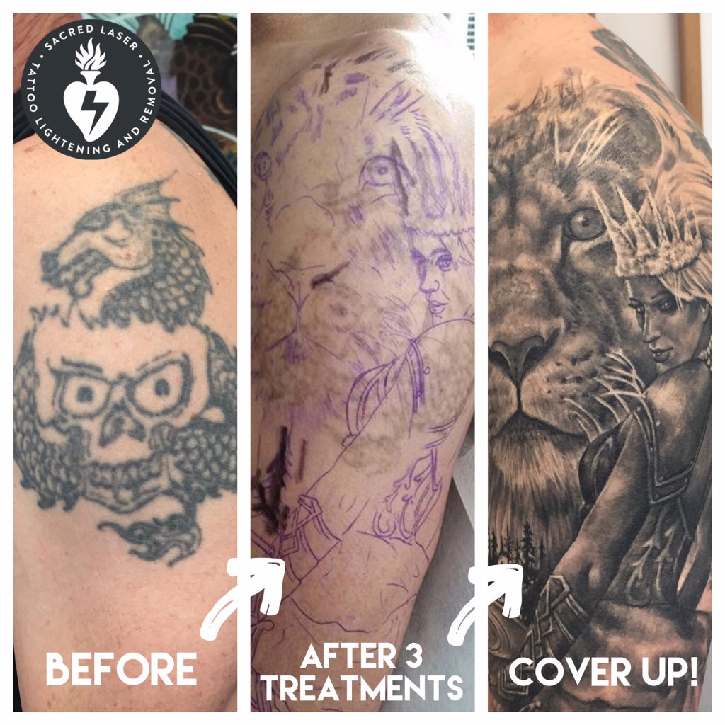 You can see the result after one session with laser tattoo removal by  bledymlodosci Cover up done by me  tattoo ta  Cover up tattoos  Tattoo removal Tattoos