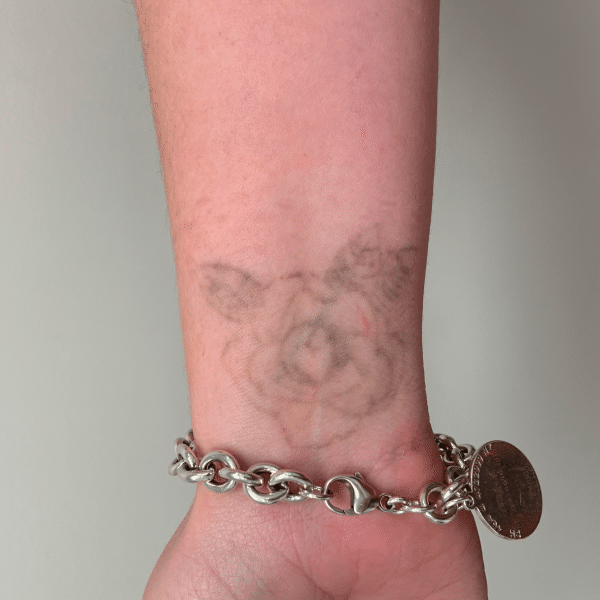 Silver chain bracelet with coin on wrist with a faded tattoo